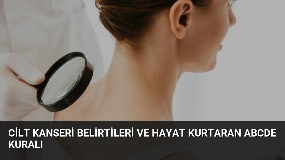 Cilt Kanseri Belirtileri ve Hayat Kurtaran ABCDE Kuralı