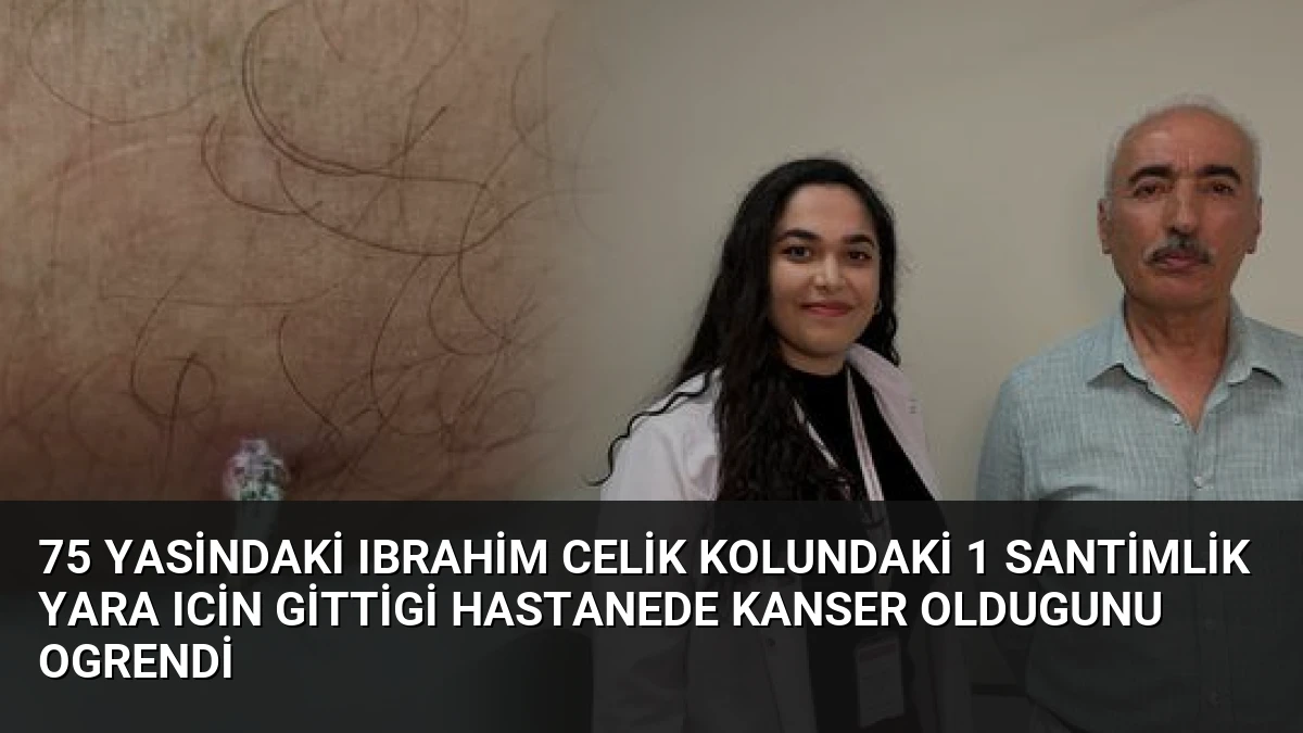 75 Yasindaki Ibrahim Celik Kolundaki 1 Santimlik Yara Icin Gittigi Hastanede Kanser Oldugunu Ogrendi