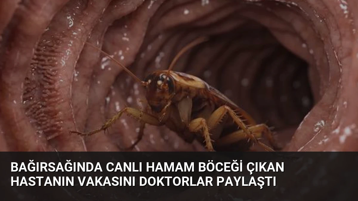Bağırsağında Canlı Hamam Böceği Çıkan Hastanın Vakasını Doktorlar Paylaştı