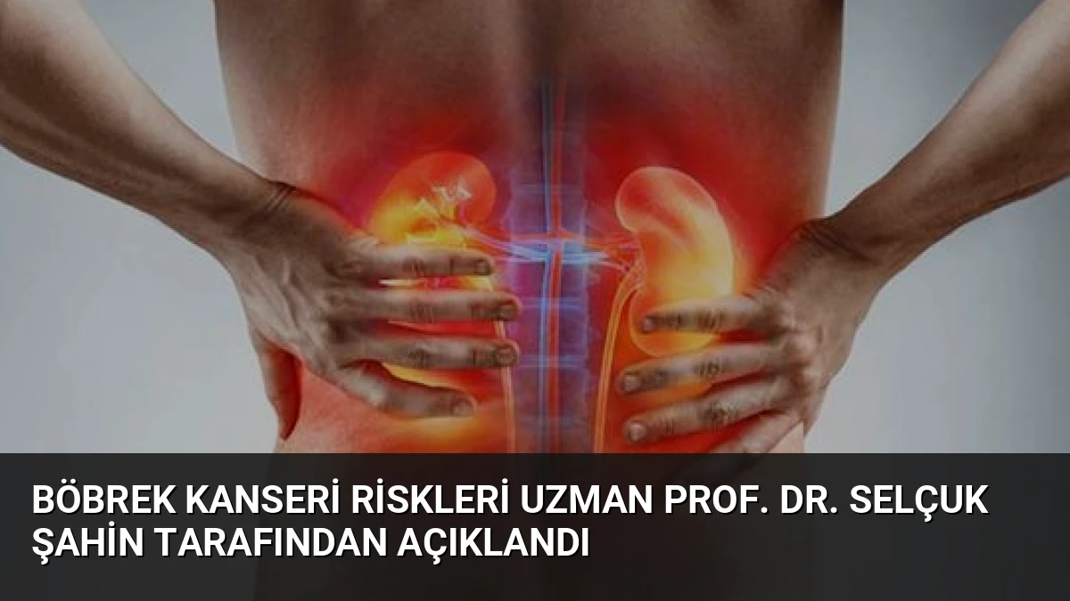 Böbrek Kanseri Riskleri Uzman Prof. Dr. Selçuk Şahin Tarafından Açıklandı